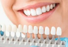 Do You Know the Ways to Affording Dental Implants? Dental Implants