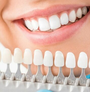 Do You Know the Ways to Affording Dental Implants? Dental Implants