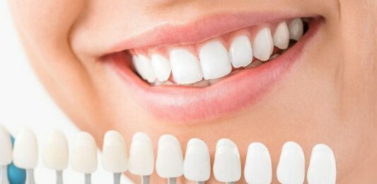 Do You Know the Ways to Affording Dental Implants? Dental Implants