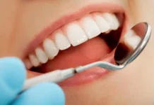 Why you should Improve your Teeth dental care