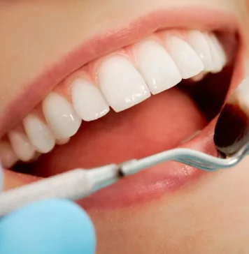 Why you should Improve your Teeth dental care